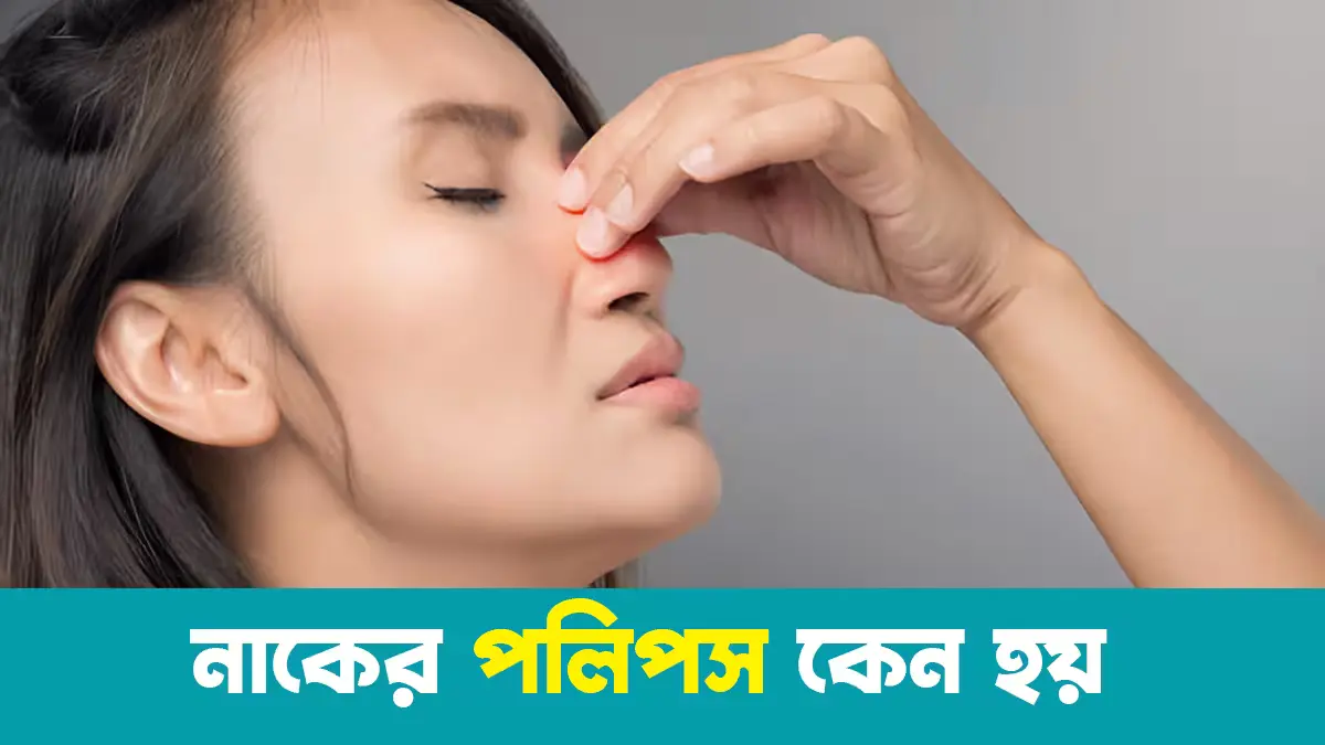 নাকের পলিপ কী এবং কেন হয়?